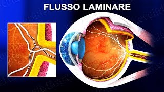 Angiografia a fluorescenza FAG e con verde indocianina ICGA wwwoculisticaTVit [upl. by Koeninger]