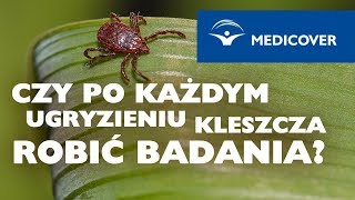 Czy po każdym ugryzieniu kleszcza trzeba robić badania [upl. by Myrtle]