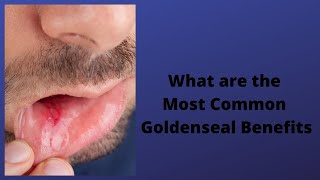 What are the Most Common Goldenseal Benefits [upl. by Honey]