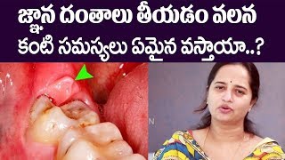 Problems of Wisdom Teeth  How to Recover Wisdom Tooth Pain After Removal  Tips for Toothache [upl. by Shari]