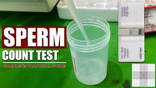 Sperm Count Lab Test  Semen Analysis  Complete video tutorial  Under Microscope [upl. by Connell607]