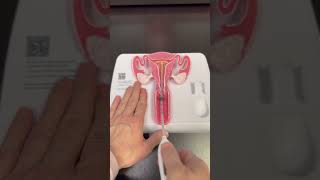 iud skyla mirena liletta kyleena paragard birthcontrol familyplanning options midwife [upl. by Auohs90]