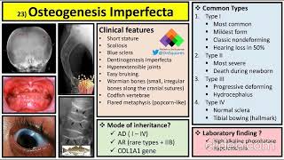 Osteogenesis imperfecta clinical features diagnosis and management [upl. by Riannon940]