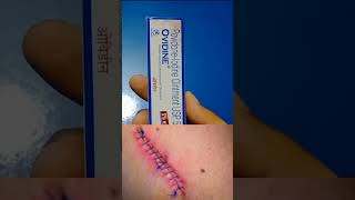 Ovidine Ointment  PovidoneIodine Ointment woundhealing viralvideo ytshorts health shorts [upl. by Melena]