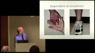 Prof Peter Rowe  quotDysautonomia and Postural Orthostatic Tachycardiaquot [upl. by Nolrac]