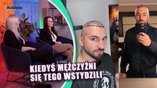 Polacy masowo przeszczepiają włosy w Turcji Dlaczego „Wynika to z ich niewiedzy” MAMY CZAS [upl. by Lock]