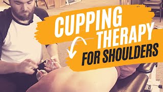 Cupping Therapy Techniques for the Shoulder [upl. by Busby]