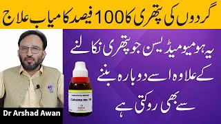 How To Remove Kidney Stones Permanently  Gurdy Ki Pathri Ka ilaj [upl. by Sunny]