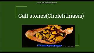 Cholelithiasis  Gallstones Pathogenesis amp Morphology [upl. by Crain849]