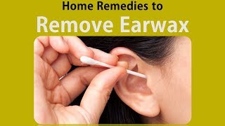 Home Remedies to Remove Earwax  Hydrogen Peroxide amp Baking Soda [upl. by Harrak667]