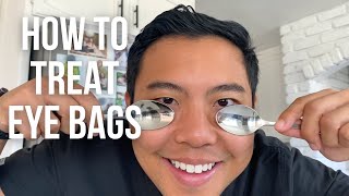 How to get rid of UNDER EYE BAGS FAST the SAFEST ways  👁 Ophthalmologist michaelchuamd [upl. by Rochell]