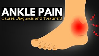 Ankle Pain Survival Guide Walking Comfortably Through Causes and Treatments [upl. by Bosch284]