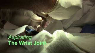 Wrist Joint Arthrocentesis [upl. by Ramedlaw947]