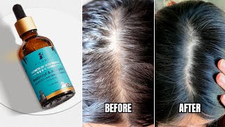 Pilgrim Redensyl amp Anagain Hair Serum For Hair Regrowth  Price Results Ingredients How To Apply [upl. by Hairabez]