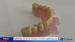 Prótesis dentales impresas en 3D😁 [upl. by Chaffin]