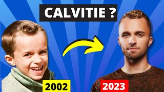 Squeezie a til vraiment une calvitie  Enfin La vérité sur sa quotpertequot de cheveux 😱 [upl. by Nnod491]