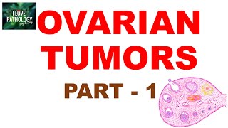 OVARIAN TUMORS  Part 1  Classification [upl. by Brenn417]