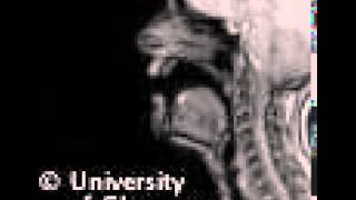 MRI voiced palatal lateralapproximant [upl. by Eahsed]