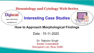 Discussion of Hematology Interesting Cases  by Dr Tejinder Singh [upl. by Bergen438]