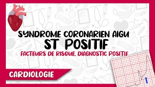 Syndrome Coronarien Aigu Segment ST Positif  Diagnostic Positif Symptomes amp ECG Complications [upl. by Gale]