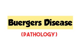 Buergers diseasemedium vessel vasculitis pathology mbbs [upl. by Konstance481]