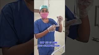 IUI insemination Live demonstration pregnancy pregnancytips femaletips drsavitha udumalpet [upl. by Eiclehc]