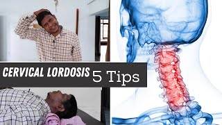 5 Best Loss of Cervical Lordosis Exercises amp Home Tips for Neck Pain [upl. by Einahpets]