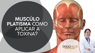 Aplicação de Toxina Botulínica no Músculo Platisma [upl. by Esten373]