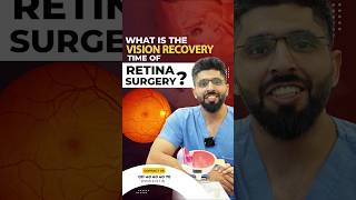 Recovery Time for Retinal Surgery [upl. by Ossy]