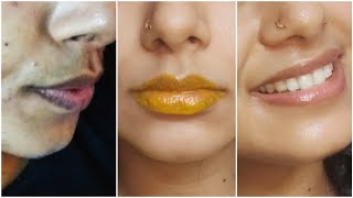 How I get rid of Pigmented Lips Naturally  Real Lip Care Routine to get soft pink lips Home Remedy [upl. by Aleetha]