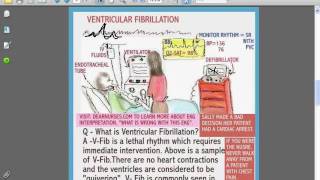 SESSIONS FOR NURSES 4  Chest Pain Assessment Documentation and Intervention 2009 05 30 16 46 [upl. by Callie]