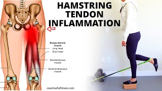 Hamstring Tendinopathy Best Relief Exercises Causes and How to Heal Tendinitis [upl. by Aramot972]