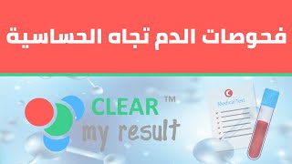 فحوصات الدم تجاه الحساسية Allergy Blood Testing [upl. by Enenstein]