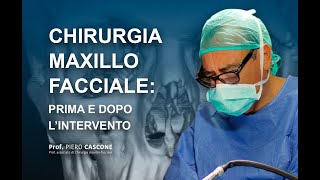 Chirurgia Maxillo Facciale Prima e Dopo lintervento [upl. by Tronna447]