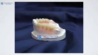 Protesi Flessibili  Dental Flex Italia [upl. by Garibald]