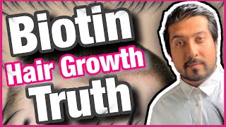 Biotin Hair Growth Truth Revealed  Is Biotin Good for Hair Growth 💇‍♂️ [upl. by Kciwdahc]