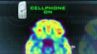 Cell Phones Mysterious Effects on the Brain 2222011 [upl. by Okoy]