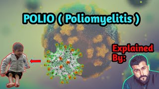 POLIO  Poliomyelitis  explained by Tariq Pathan [upl. by Blondelle]