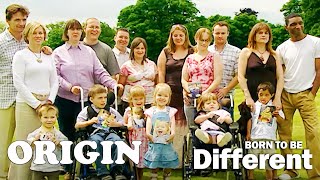 Meet The Incredible Children Born With Disabilities  Born To Be Different  Part 4  Origin [upl. by Changaris]