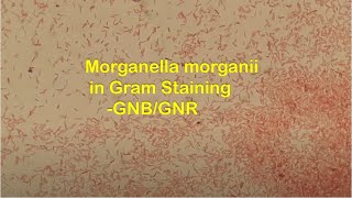 Gram Negative Rods of Morganella morganii in Gram Staining [upl. by Adabelle1]