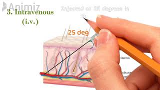 Injection techniques  Intramuscular im  Subcutaneous sc  Intravenous iv  Intradermal id [upl. by Ardnohsed]