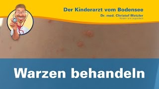 Warzen behandeln  Der Kinderarzt vom Bodensee Warzen 22 [upl. by Otreblaug]