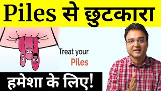 10 Tips To Get Rid Of Piles  Piles Treatment At Home  पाइल्स का इलाज  by Dr Saleem Zaidi [upl. by Simaj453]