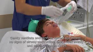 IV Insertion Technique in Infants and Small Children [upl. by Ardnuaek374]