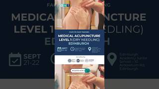 Back Pain Relief using Medical Acupuncture dry needling osteopathy backpain [upl. by Elda]