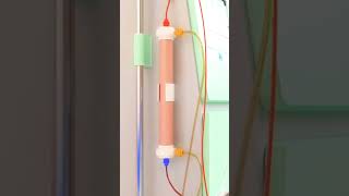 dialysis process animation dialysistechnician kidney bloodcleanser [upl. by Rambert]