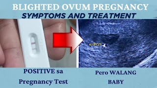 BLIGHTED OVUM PREGNANCY  SYMPTOMS AND TREATMENT [upl. by Alenoel789]