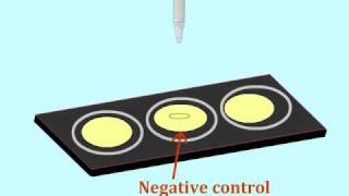 Agglutination assay to detect antigens  MultiLingual Captions [upl. by Vanderhoek349]