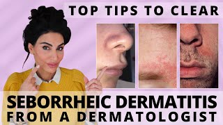 Top Tips to Clear Seborrheic Dermatitis  Dermatologist Deep Dive [upl. by Nnaarual]