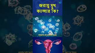 জরায়ু মুখ ক্যান্সার কি  What is Cervical cancer I Jorayu Cancer I sasthosebokcom [upl. by Aduhey647]